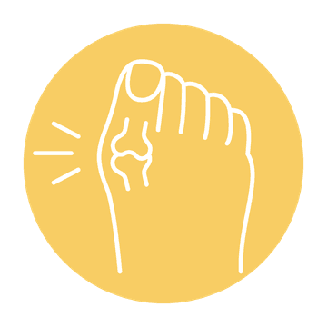 Prevention of Corns and Calluses