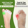 HIKE Foot Toe Separator -  Achieve Healthy Toes, Correct Bunions, Hammer Toes, and Relieve Foot Pain